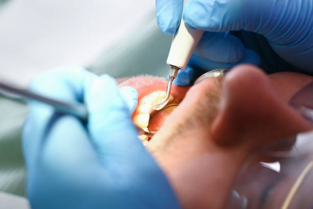 Best Walk-In Emergency Dentist in Milan, MO